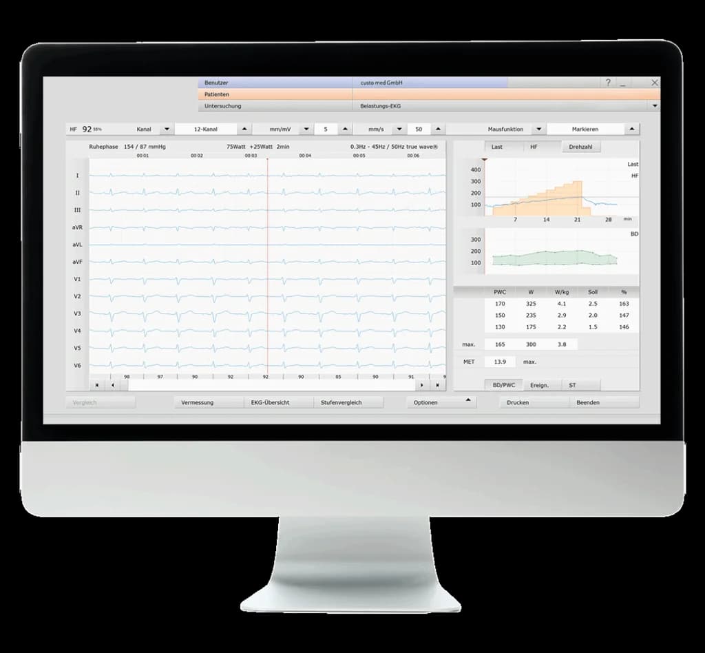 Épreuve d’effort dans custo diagnostic ergo