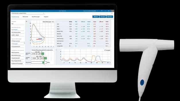 custo spiro mobile avec custo diagnostic vit