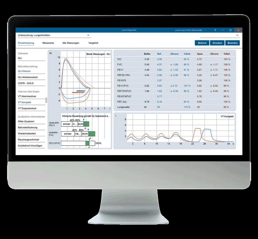 Écran du module custo diagnostic vit