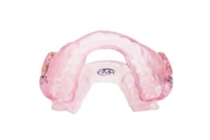 Orthèse d'avancée mandibulaire SomnoDent Flex : vue frontale de l’orthèse d’avancée mandibulaire et de ses articulations latérales