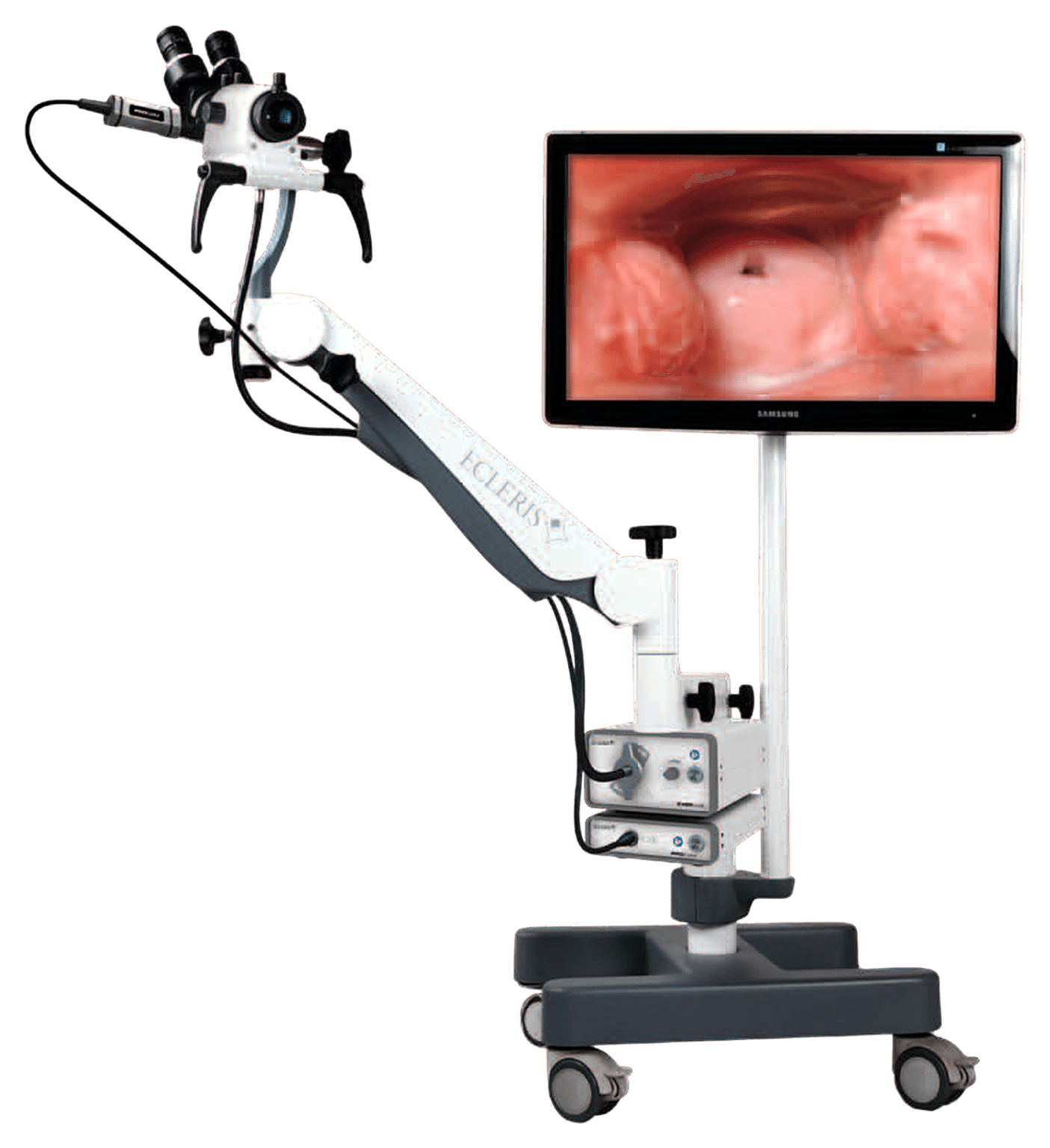 Colposcope Ecleris C-100 : colposcope sur pied mobile avec optique, bras articulé et moniteur vidéo