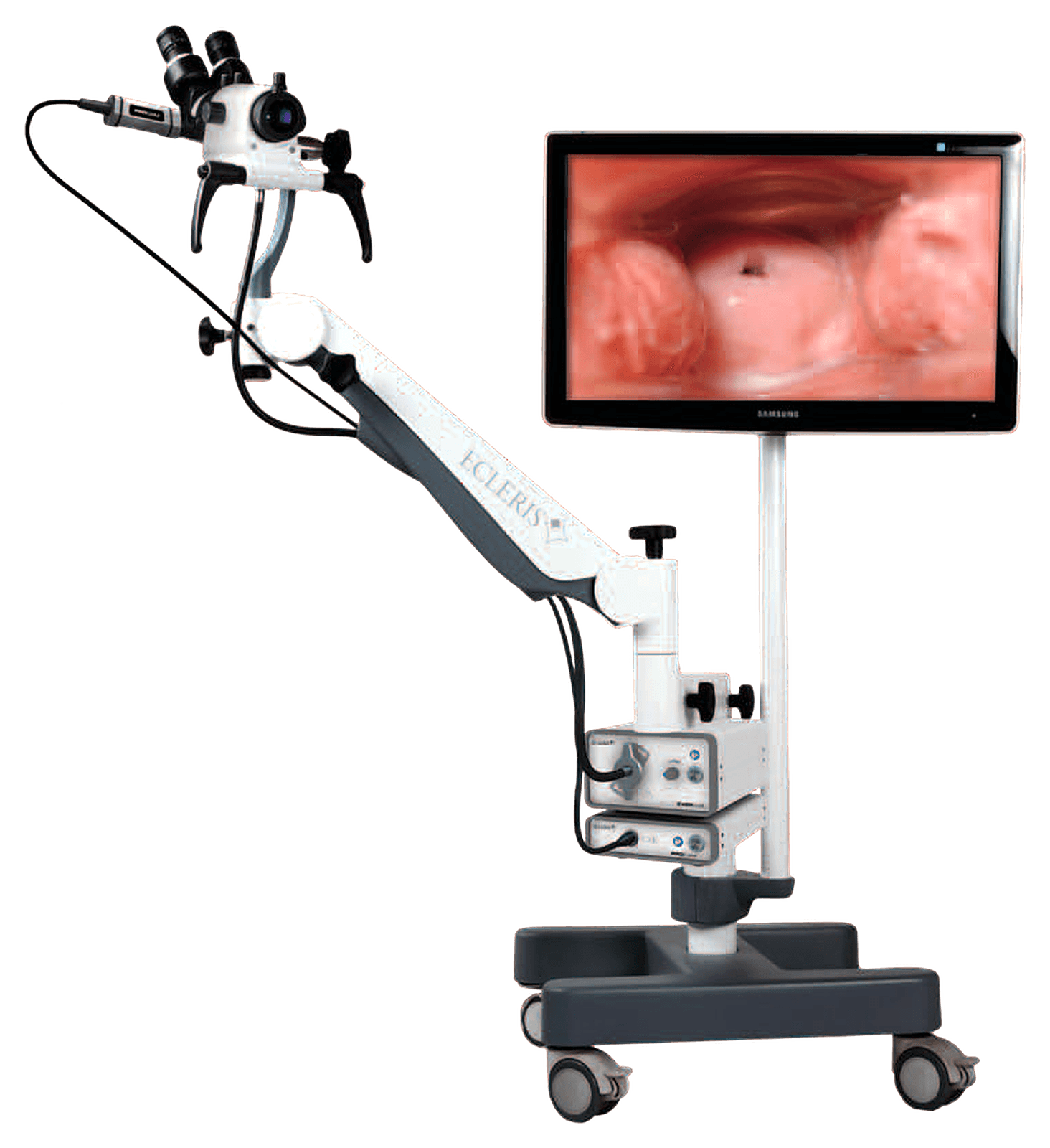 Colposcope Ecleris C-100 : colposcope sur pied mobile avec optique, bras articulé et moniteur vidéo
