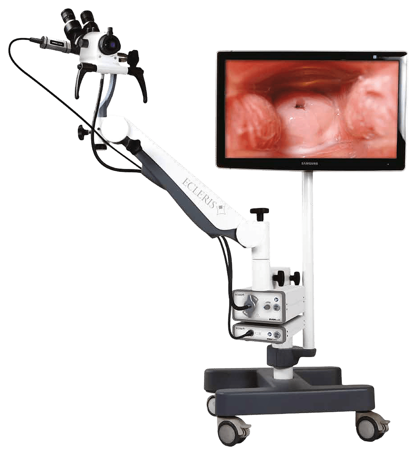 Colposcope Ecleris C-100A : colposcope sur pied mobile avec optique, bras articulé et moniteur vidéo