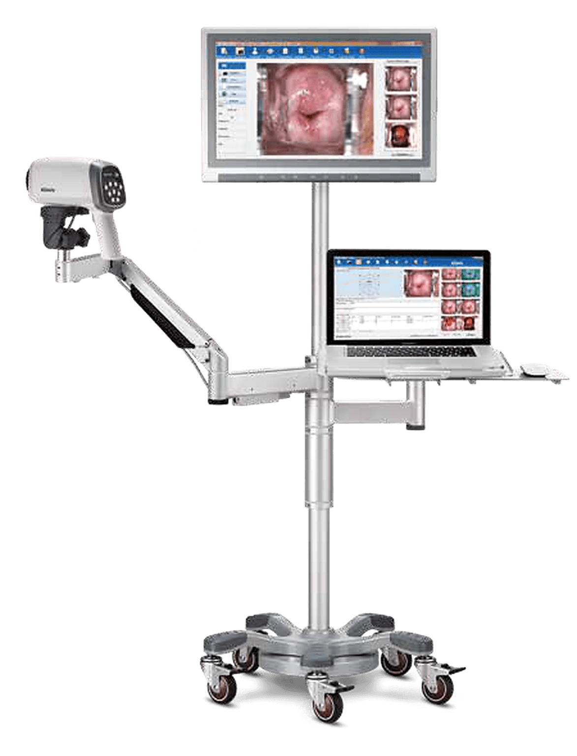 Colposcope vidéo EDAN C6A HD : colposcope sur pied mobile avec optique, bras articulé et moniteur vidéo