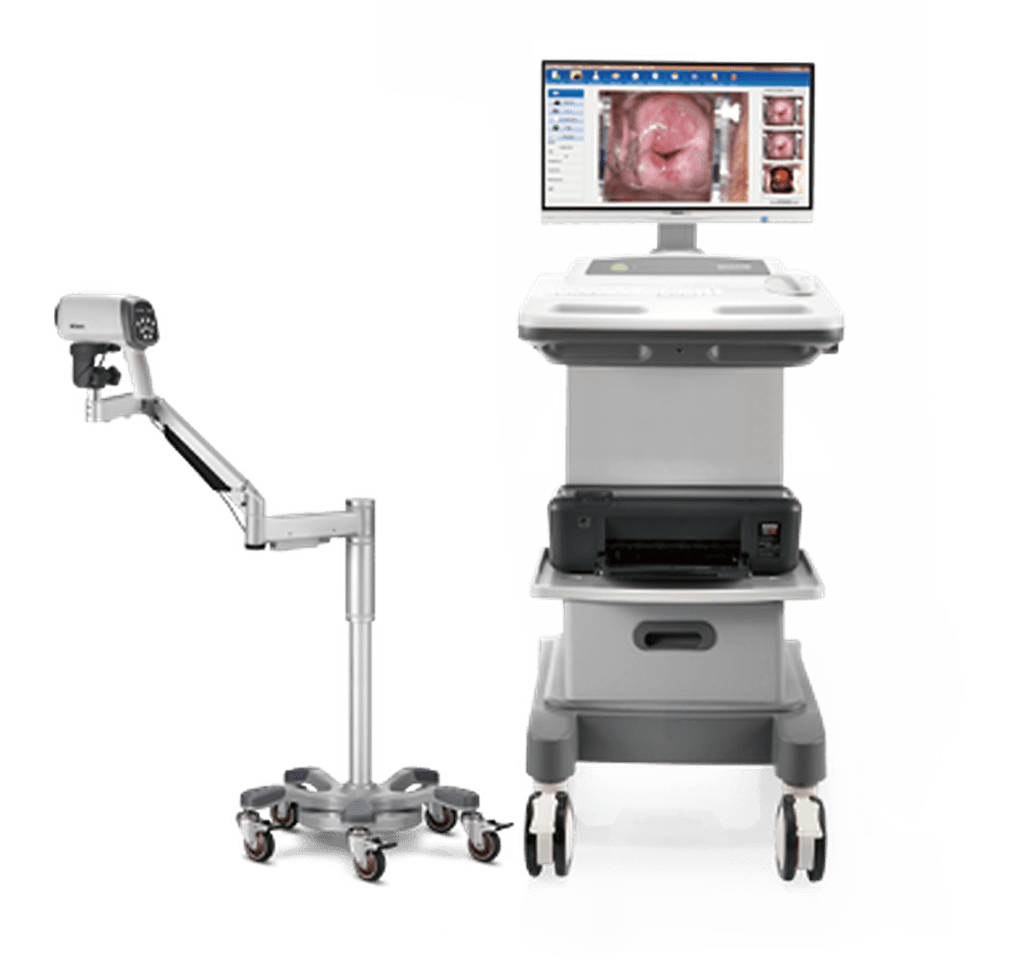 Colposcope vidéo EDAN C6 HD : colposcope sur pied mobile avec optique, bras articulé et moniteur vidéo