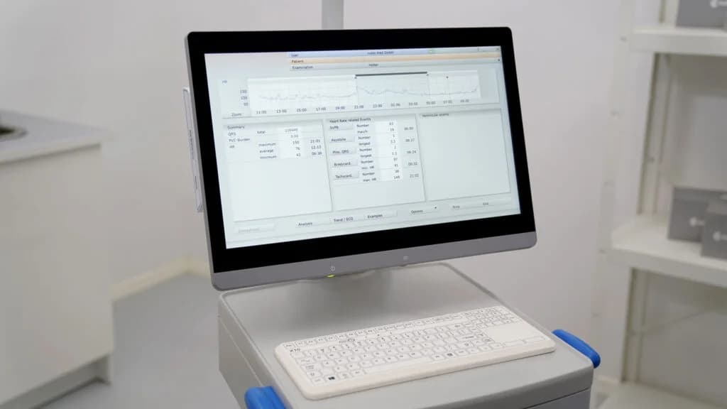 Analyse d’un enregistrement Holter dans custo diagnostic tera