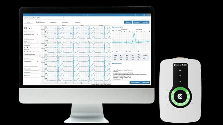 Système ECG relié à l’écran custo diagnostic