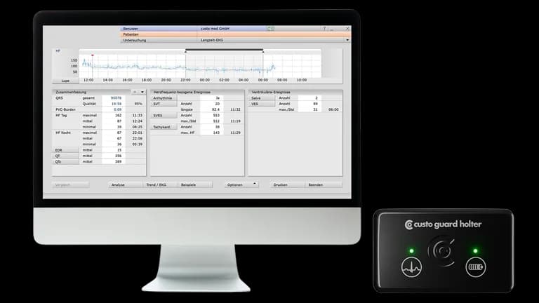 Enregistreur Holter Customed et écran d’analyse custo diagnostic tera
