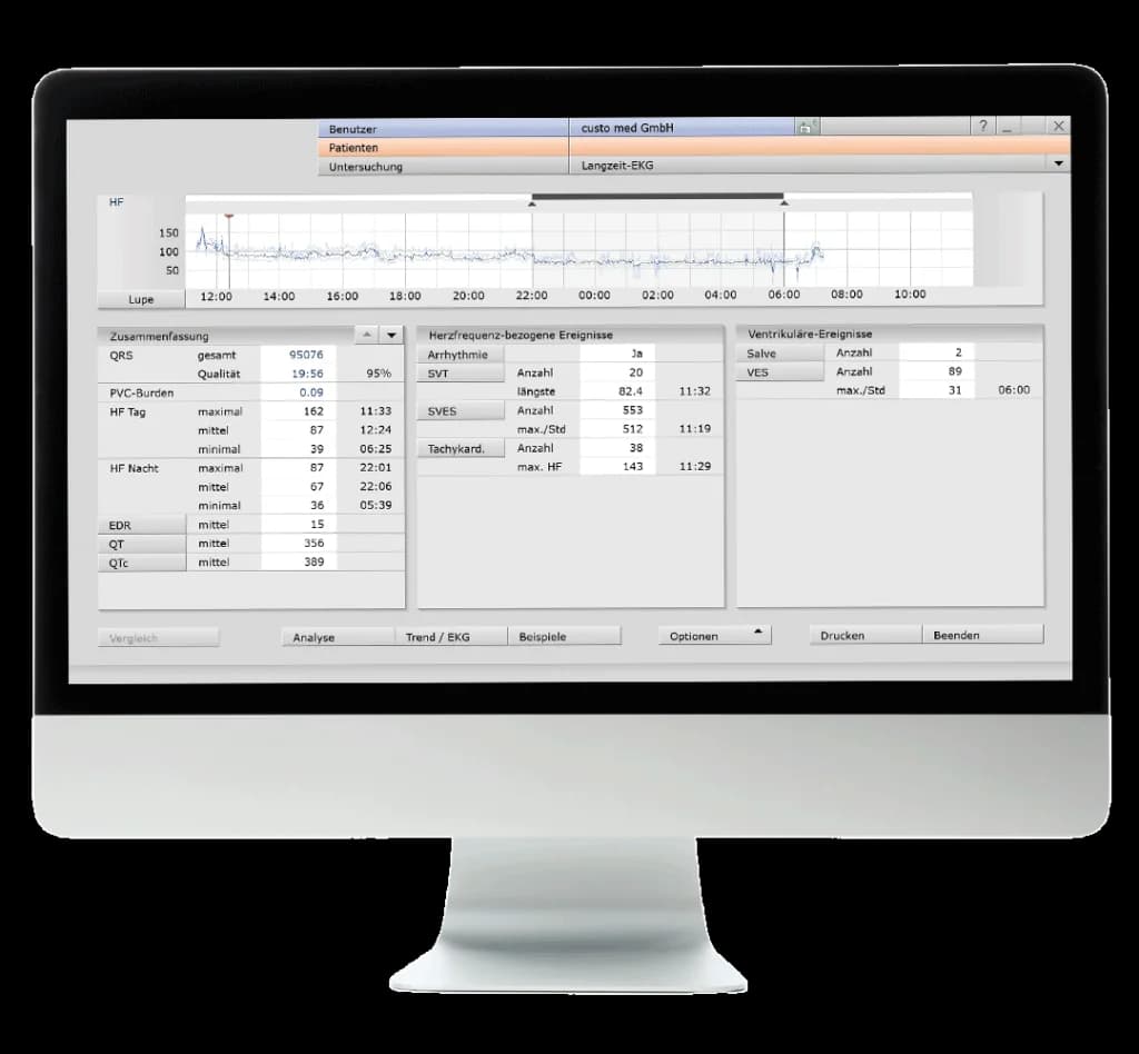 Vue des événements dans custo diagnostic tera