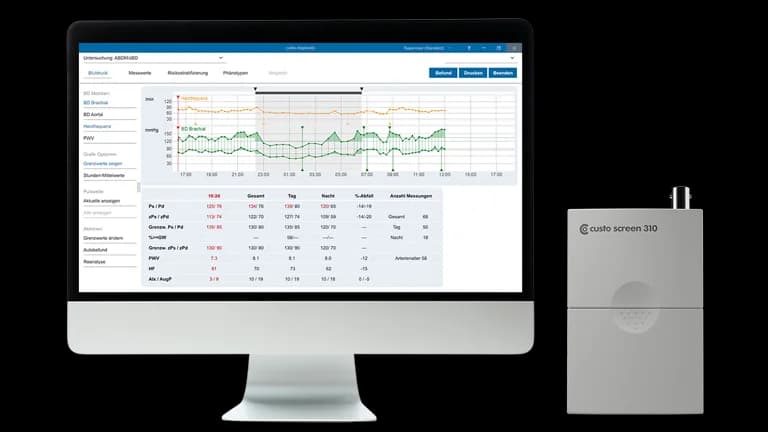custo screen 310 et analyse de pression centrale