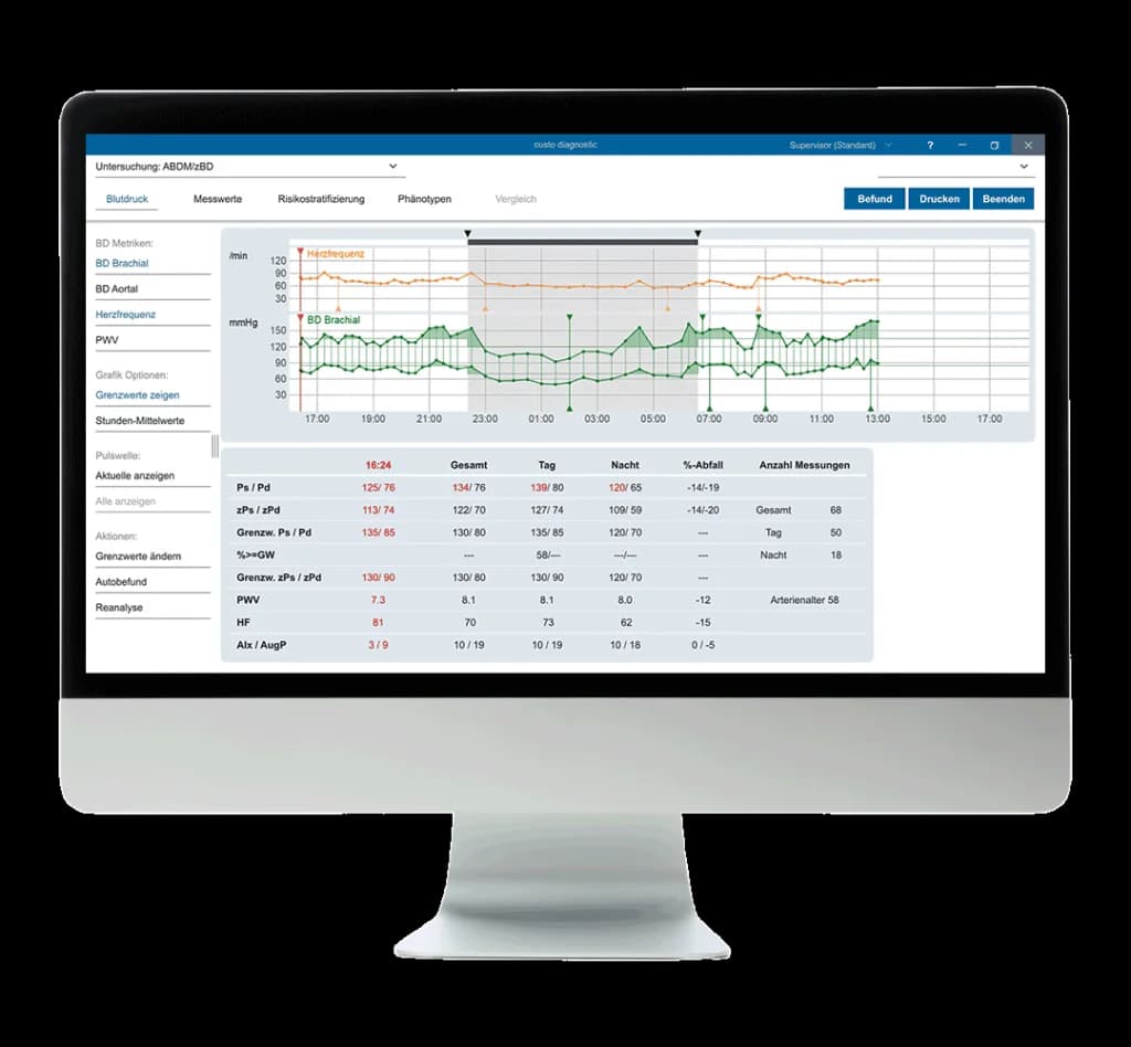 Profil jour et nuit dans custo diagnostic screen