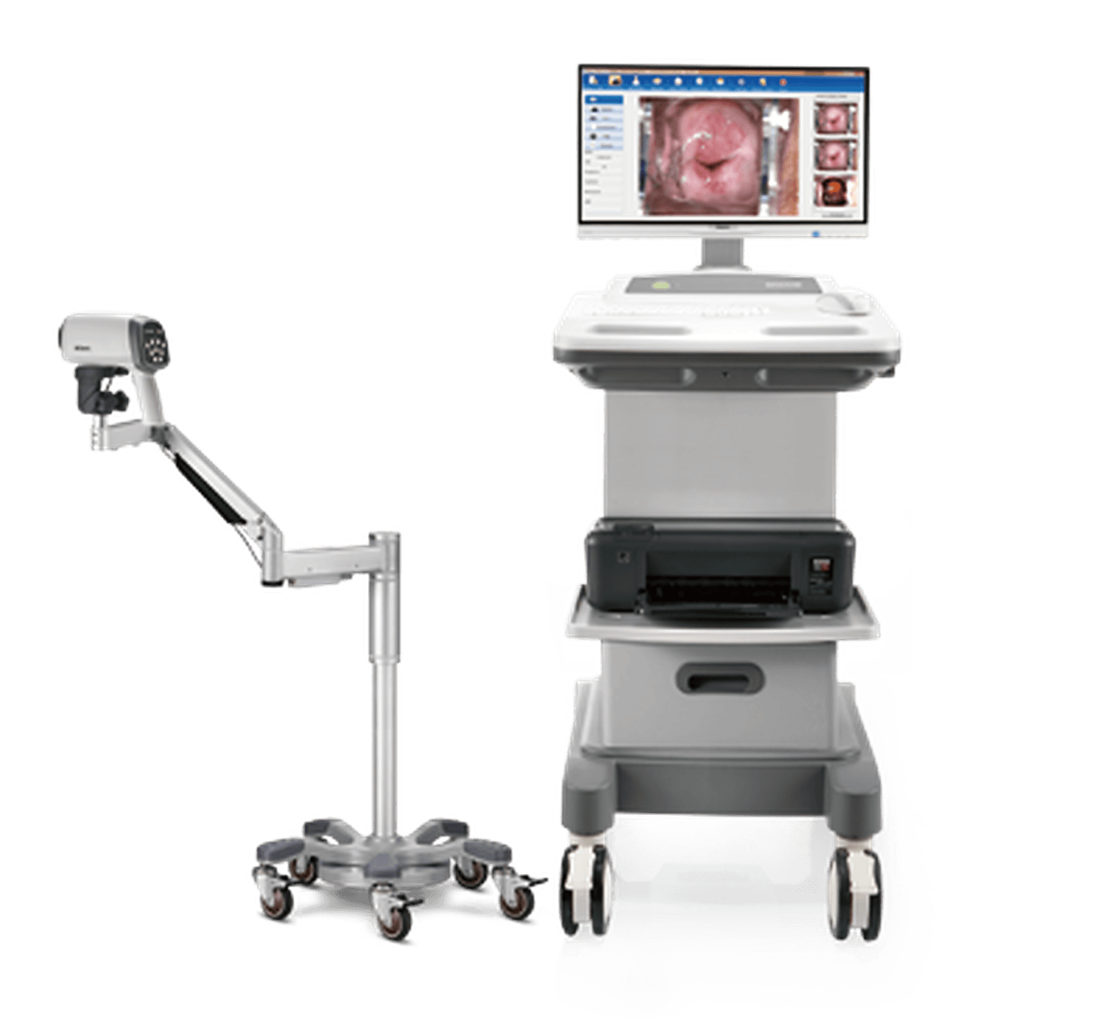 Colposcope vidéo EDAN C6 HD : colposcope sur pied mobile avec optique, bras articulé et moniteur vidéo
